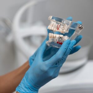 Karşıyaka implant tedavisi