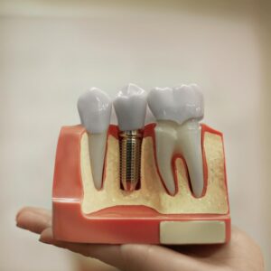 Çiğli diş implantı