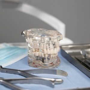 Konak diş implantı