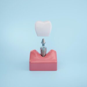 implant tedavisi